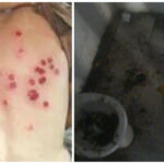 Condiciones de detención