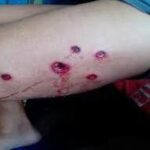 Detenido con heridas de bala