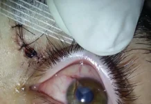 Agresión en el boliche Roca Bruja de Hurlingham