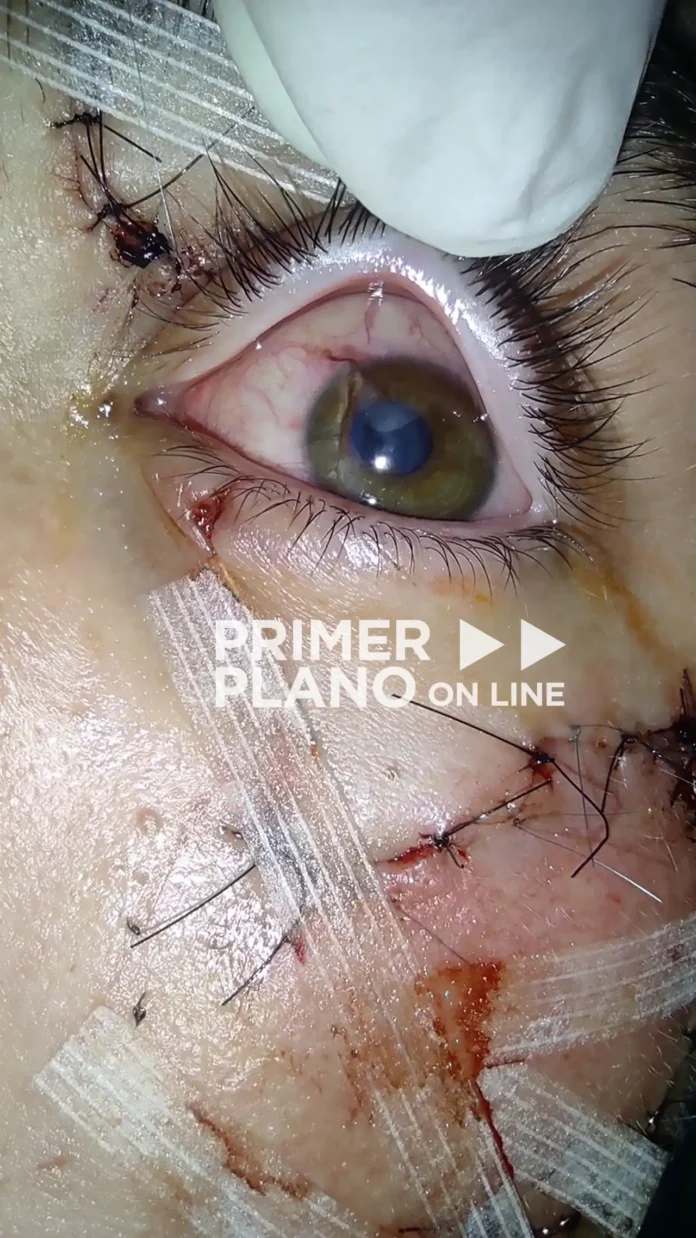 Agresión en el boliche Roca Bruja de Hurlingham