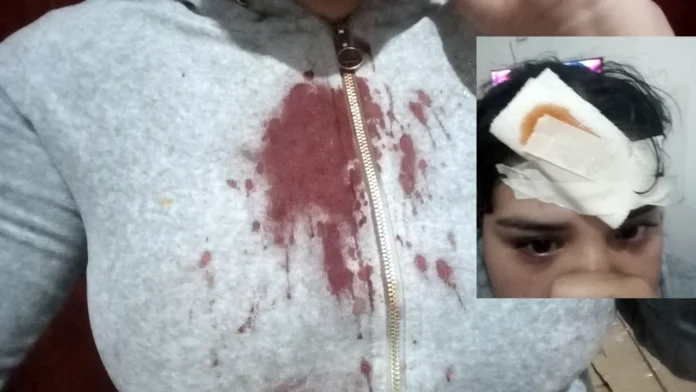 Violenta agresión a joven embarazada