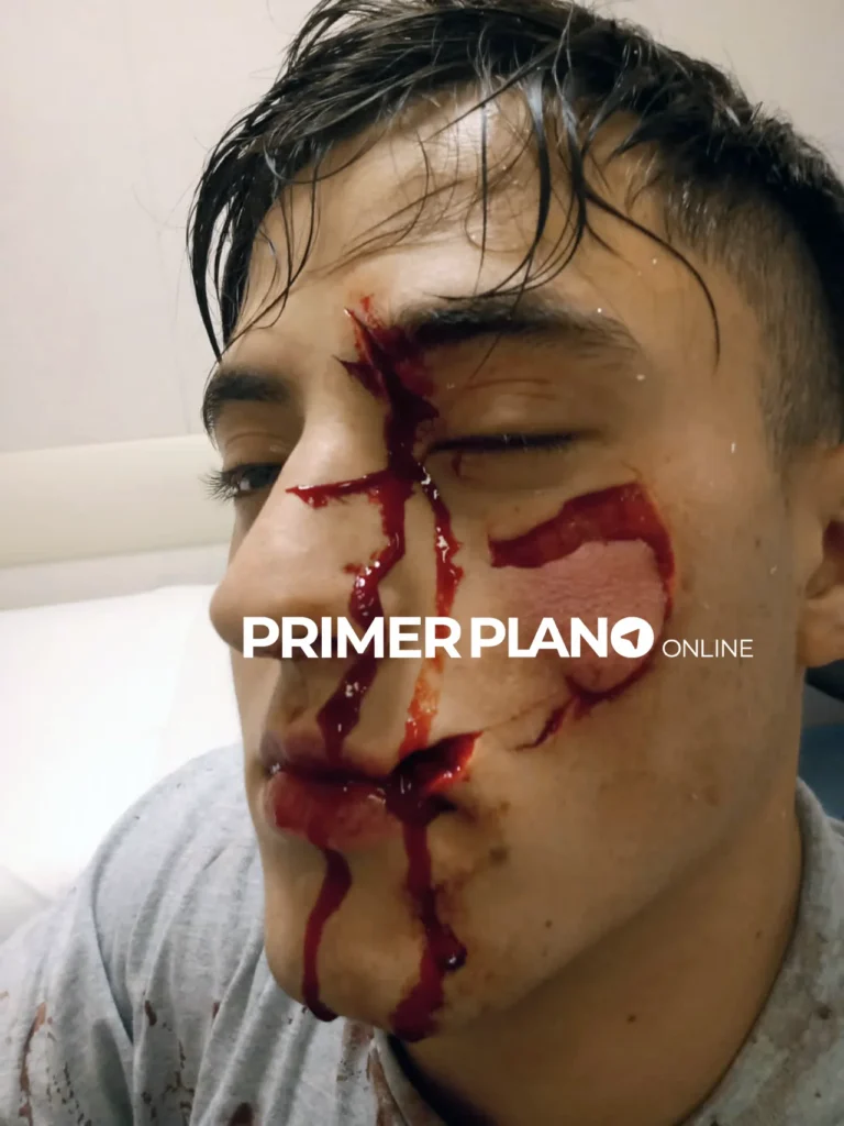 Juicio por la agresión en el boliche Roca Bruja