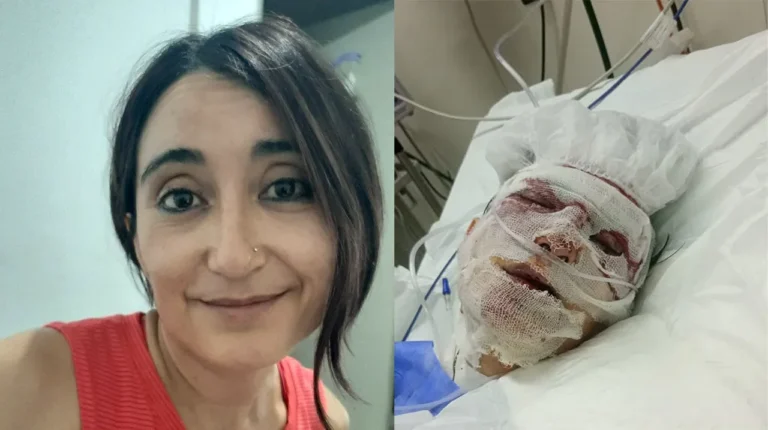 Ataque motochorro a una mujer en Merlo