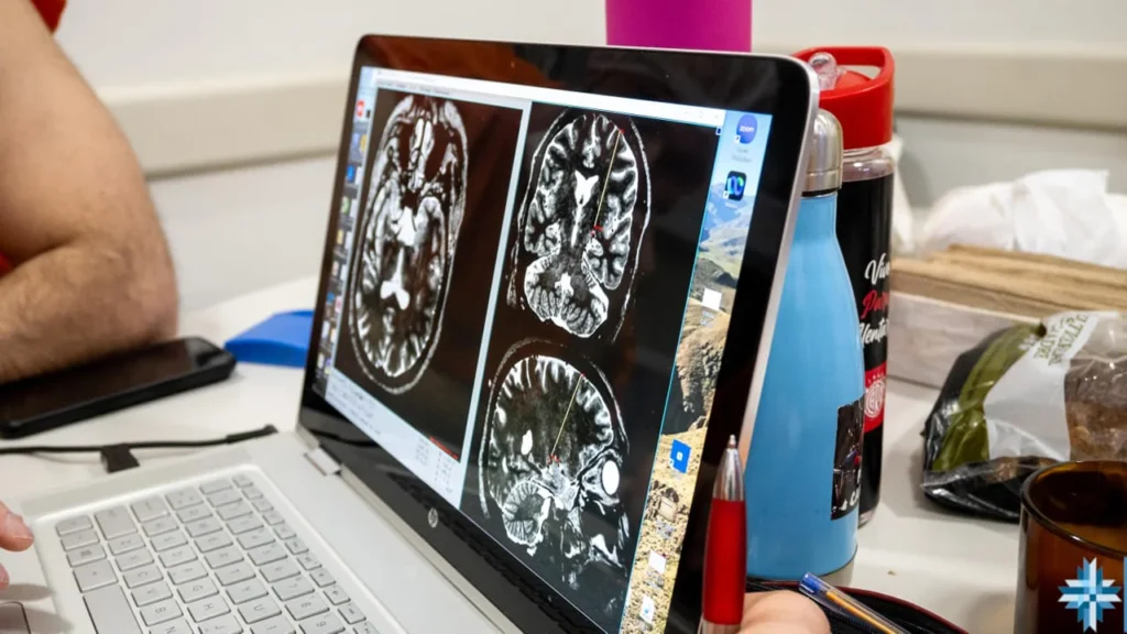 Neurocirugía en el hospital Favaloro