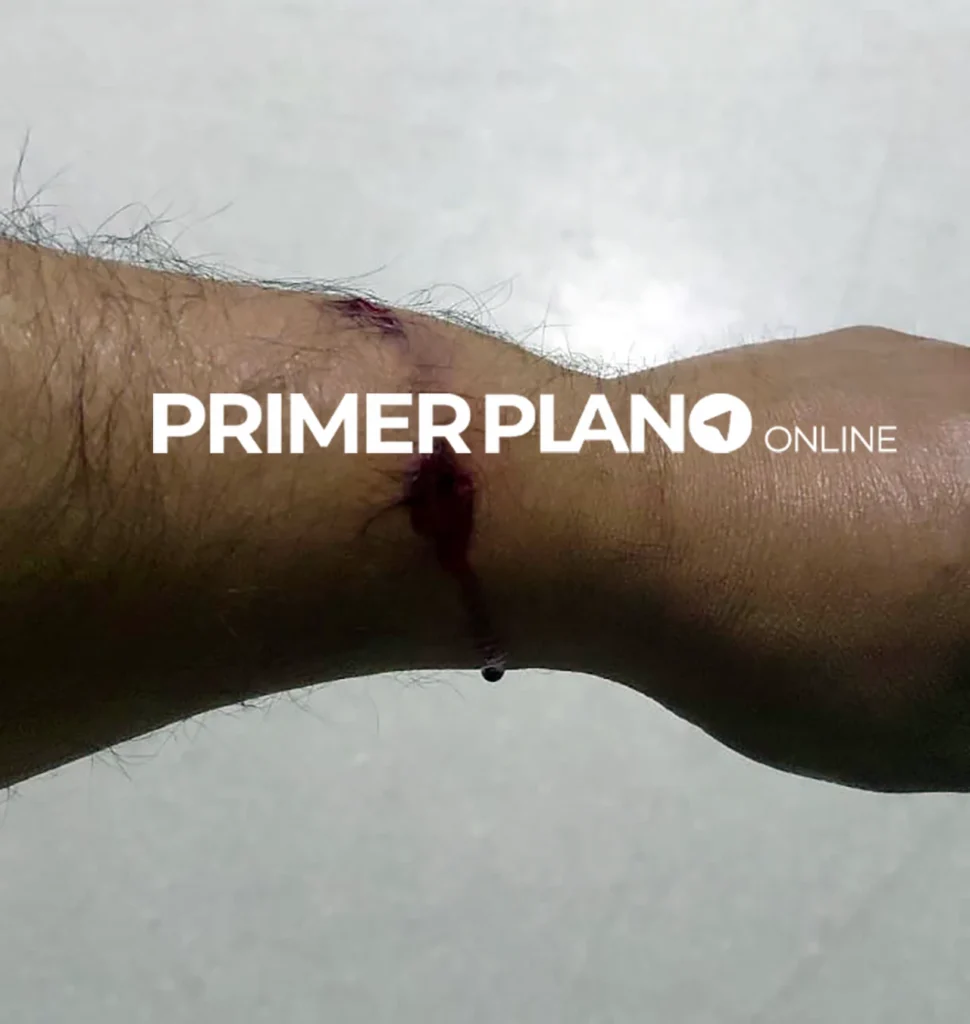 Ataque a Rubén Carballo