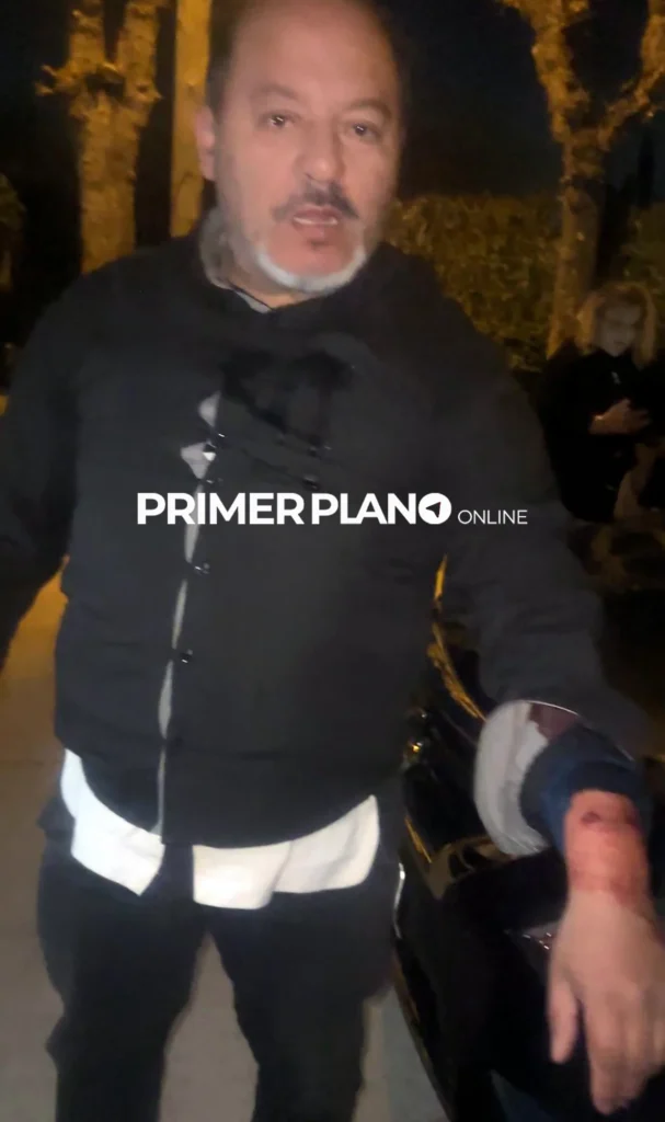 Ataque a Rubén Carballo