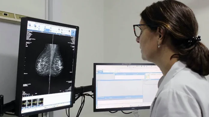 Mamografías preventivas