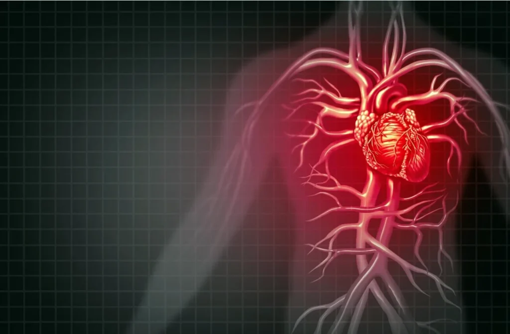 Depresión y riesgo cardiovascular