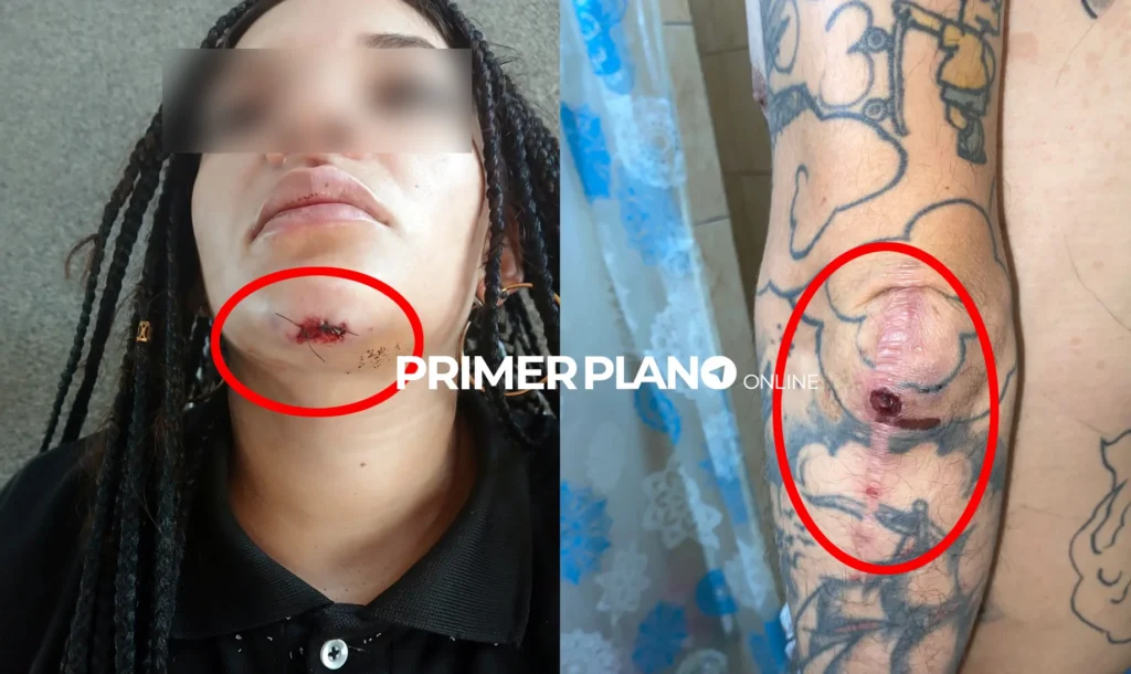 Agresión del dueño de El Coliseo a trabajadores