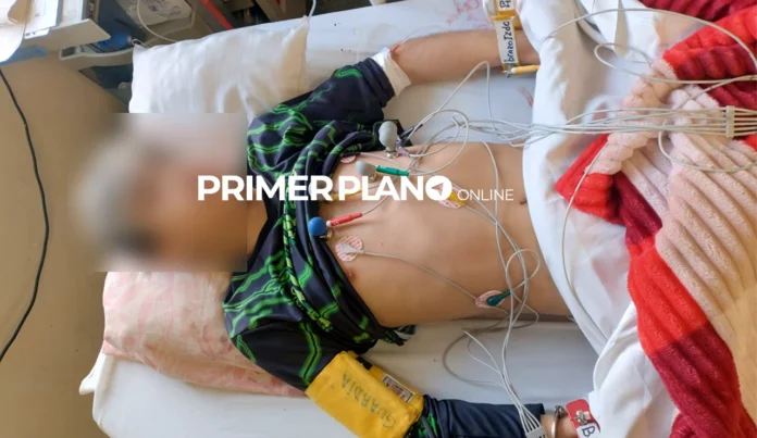 La caída de El Perri en Palomar