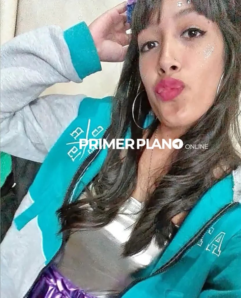 Ataque con ácido contra Agustina