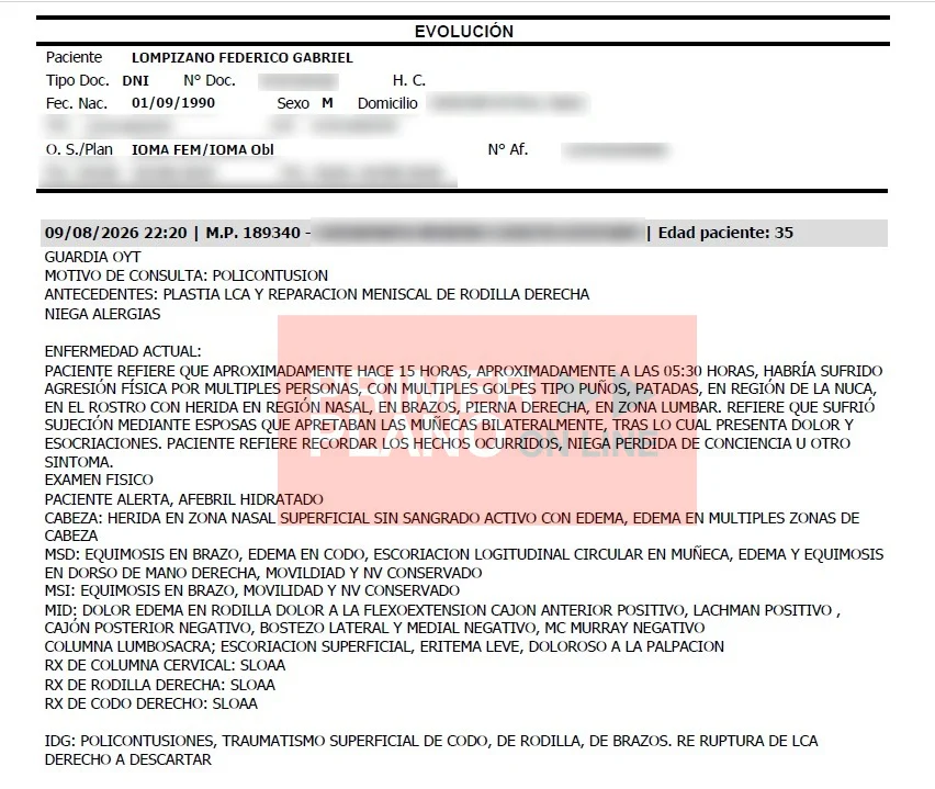 Escándalo en comisaría de Padua