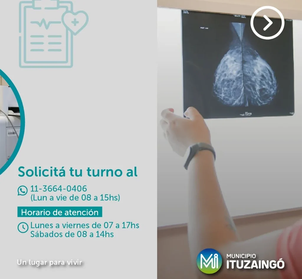 Mamografías en el CEDIM